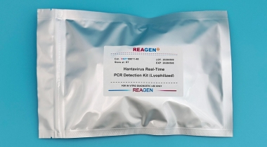 Hantavirus Real-Time PCR Detection Kit Manual (Lyophilized)<m met-id=824 met-table=product met-field=title></m>